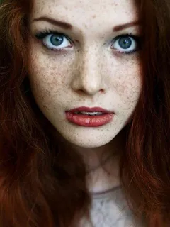 freckles